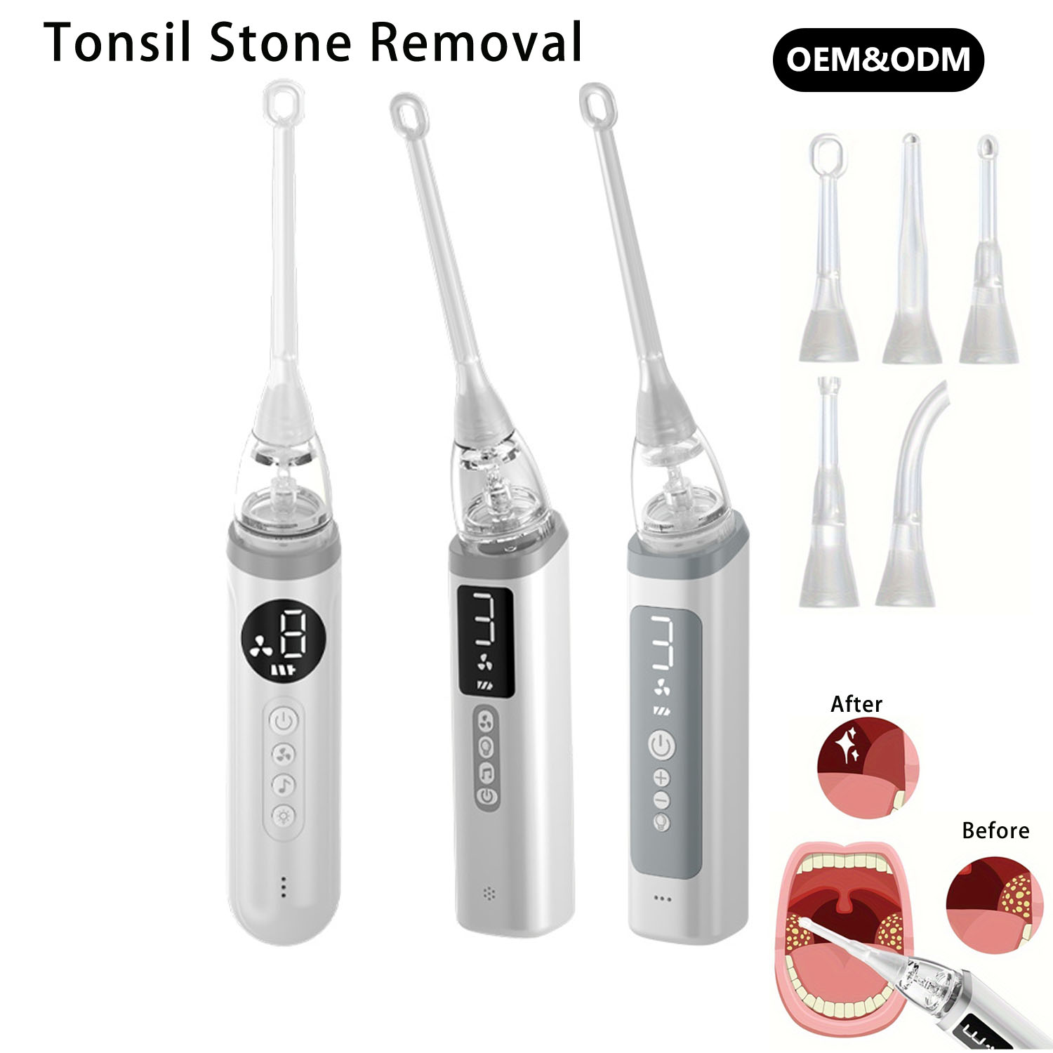Vaccum Tonsil Stone Removal (2)