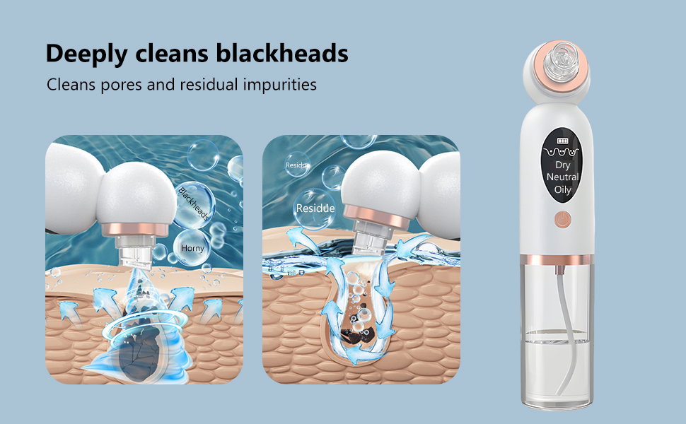 facial pore cleaner (5)