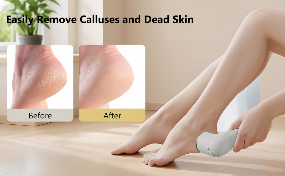 electric callus remover (2)