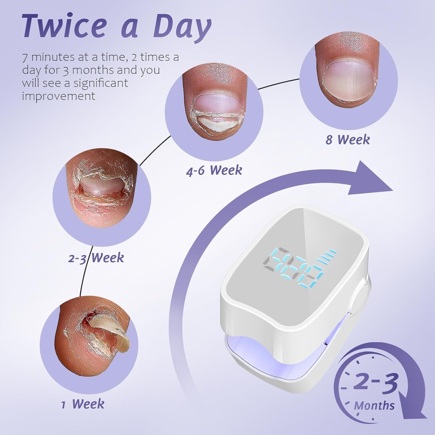 nail fungus lamp (15)