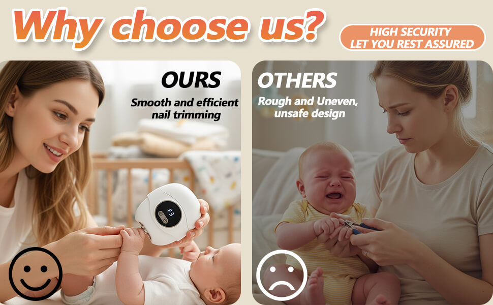 foot callus remover (3)