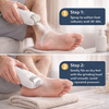 Callus remover electric